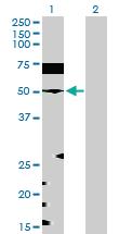 Anti-EEF1G Rabbit Polyclonal Antibody