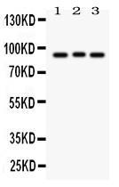 Anti-SEMA3A Rabbit Polyclonal Antibody