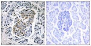 Immunohistochemical analysis of paraffin-embedded human pancreas tissue using Anti-MtSSB Antibody The right hand panel represents a negative control, where the antibody was pre-incubated with the immunising peptide