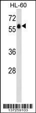 Anti-GPR97 Rabbit Polyclonal Antibody (AP (Alkaline Phosphatase))