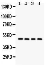 Anti-SERPINA1 Rabbit Polyclonal Antibody