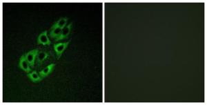 Immunofluorescence analysis of A549 cells using Anti-MtSSB Antibody The right hand panel represents a negative control, where the antibody was pre-incubated with the immunising peptide