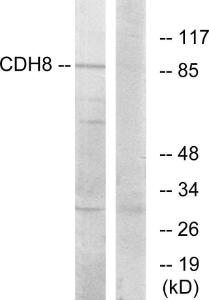 Antibody anti-CDH8 A95379-100 100 µg