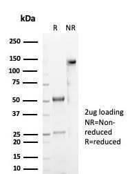 Antibody anti-CD59 MACIF7021R 100 µg