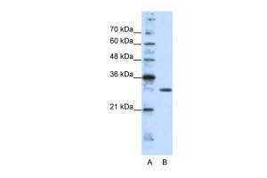 Anti-GSC2 Rabbit Polyclonal Antibody