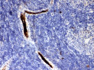 Anti-SERPINA1 Rabbit Polyclonal Antibody