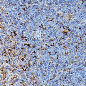 Immunohistochemistry analysis of paraffin-embedded rat spleen using Anti-MHC Class II beta Antibody (A306106) at a dilution of 1:100 (40X lens). Perform high pressure antigen retrieval with 10 mM citrate buffer pH 6.0 before commencing with IHC staining protocol