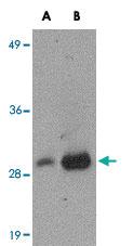 Anti-XBP1 Mouse Monoclonal Antibody [clone: 9B7E5]