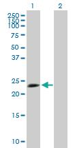 Anti-TPD52L1 Mouse Polyclonal Antibody