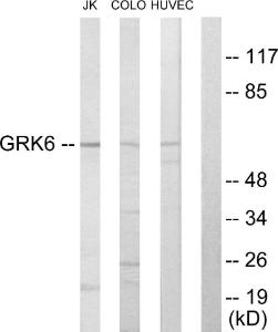 Western blot analysis of lysates from Jurkat, COLO205, and HUVEC cells using Anti-GRK6 Antibody. The right hand lane represents a negative control, where the antibody is blocked by the immunising peptide.