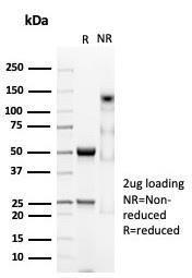 SDS-PAGE analysis of Anti-CD74 Antibody [CLIP/7023R] under non-reduced and reduced conditions; showing intact IgG and intact heavy and light chains, respectively. SDS-PAGE analysis confirms the integrity and purity of the antibody