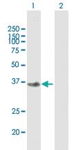 Anti-FBXO2 Mouse Polyclonal Antibody