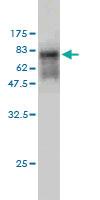 Anti-DMRT1 Mouse Monoclonal Antibody [clone: 1G11]