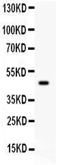 Anti-SERPINB2 Rabbit Polyclonal Antibody