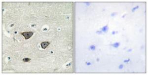 Antibody anti-CDH8 A95379-100 100 µg