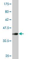 Anti-SLC13A3 Mouse Monoclonal Antibody [clone: 3A6]