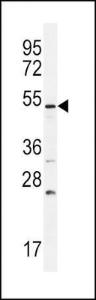 Anti-BMPR1B Rabbit Polyclonal Antibody