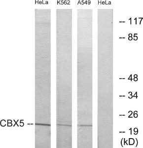 Anti-CBX5 antibody