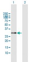 Anti-HOXB1 Mouse Polyclonal Antibody