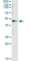 Anti-HDAC8 Antibody Pair