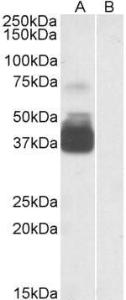 Anti-P2RX7 Antibody (A84694) staining (0.3 µg/ml) of Human Brain (Frontal Cortex) lysate (35 µg protein in RIPA buffer) with (B) and without (A) blocking with the immunising peptide. Primary incubation was 1 hour. Detected by chemiluminescence