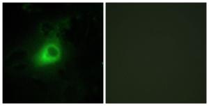 Immunofluorescence analysis of HeLa cells using Anti-GRK6 Antibody. The right hand panel represents a negative control, where the antibody was pre-incubated with the immunising peptide.