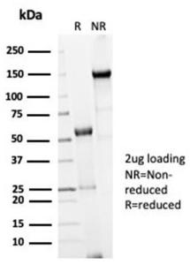 SDS-PAGE analysis of Anti-CDC20 Antibody [CDC20/7026R] under non-reduced and reduced conditions; showing intact IgG and intact heavy and light chains, respectively SDS-PAGE analysis confirms the integrity and purity of the antibody