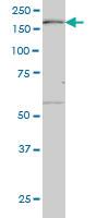 Anti-MAP3K4 Mouse Monoclonal Antibody [clone: 4F10]