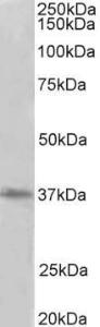 Anti-PRMT2 Antibody (A83107) (2 µg/ml) staining of HeLa lysate (35 µg protein in RIPA buffer). Primary incubation was 1 hour. Detected by chemiluminescence