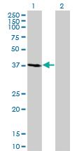 Anti-FBXO2 Mouse Monoclonal Antibody [clone: 1G4]