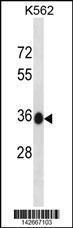 Anti-MMACHC Rabbit Polyclonal Antibody (FITC (Fluorescein Isothiocyanate))