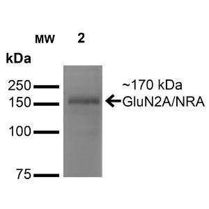 Anti-NMDAR2A antibody