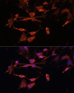 Immunofluorescence analysis of C6 cells using Anti-MHC Class II beta Antibody (A306106) at a dilution of 1:100. DAPI was used to stain the cell nuclei (blue)