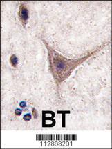 Anti-CDH10 Rabbit Polyclonal Antibody (Biotin)