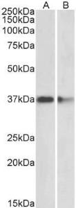 Anti-PRMT2 Antibody (A83107) (2 µg/ml) staining of Mouse (A) and Rat (B) Brain lysates (35 µg protein in RIPA buffer). Primary incubation was 1 hour. Detected by chemiluminescence