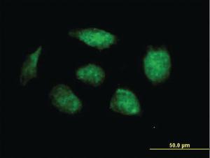 Anti-HOXB1 Mouse Polyclonal Antibody