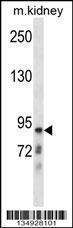 Anti-CLCNKB Rabbit Polyclonal Antibody (HRP (Horseradish Peroxidase))