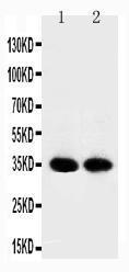 Anti-APE1 Rabbit Polyclonal Antibody