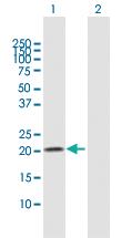 Anti-N6AMT1 Rabbit Polyclonal Antibody