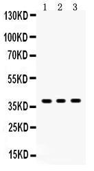 Anti-SIRT6 Rabbit Polyclonal Antibody