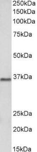 Anti-PRMT2 Antibody (A83107) (2 µg/ml) staining of Pig Brain lysate (35 µg protein in RIPA buffer). Primary incubation was 1 hour. Detected by chemiluminescence