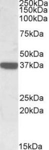 Anti-CNN3 Antibody (A84696) (0.3µg/ml) staining of Human Duodenum lysate (35µg protein in RIPA buffer). Primary incubation was 1 hour. Detected by chemiluminescence.