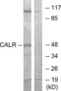 Western blot analysis of lysates from COS7 cells using Anti-CALR Antibody The right hand lane represents a negative control, where the antibody is blocked by the immunising peptide