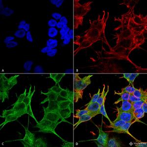 Anti-NMDAR2A antibody