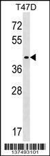 Anti-MMADHC Rabbit Polyclonal Antibody (AP (Alkaline Phosphatase))