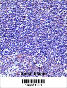 Anti-TUBA4A Rabbit Polyclonal Antibody (Biotin)