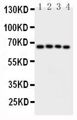 Anti-CAMKK2 Rabbit Polyclonal Antibody