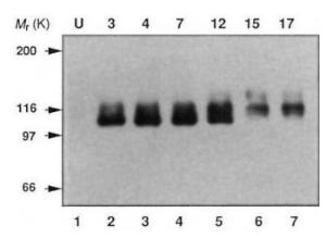 Anti-Amyloid precursor protein antibody