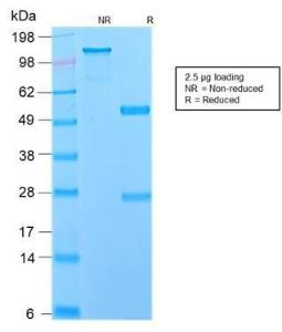 SDS-PAGE analysis of Anti-p75 NGF Receptor Antibody [NGFR/2550R] under non-reduced and reduced conditions; showing intact IgG and intact heavy and light chains, respectively. SDS-PAGE analysis confirms the integrity and purity of the antibody.