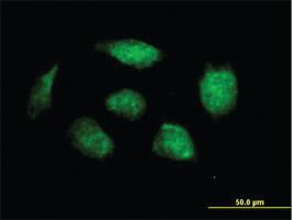 Anti-HOXB1 Mouse Polyclonal Antibody